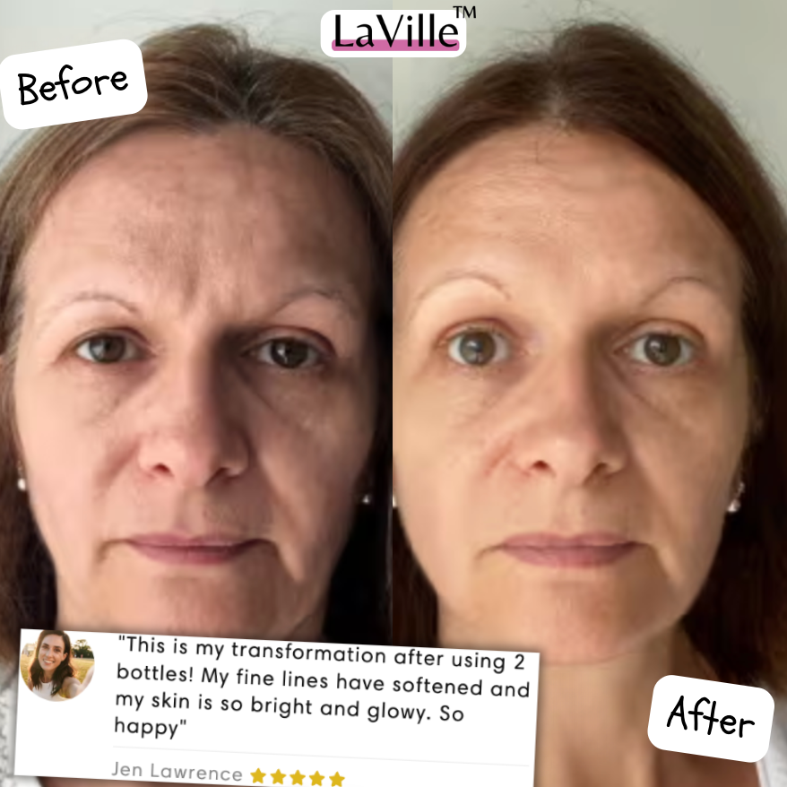 Collagen Face Masks  Laville™ 4 FreeGifts